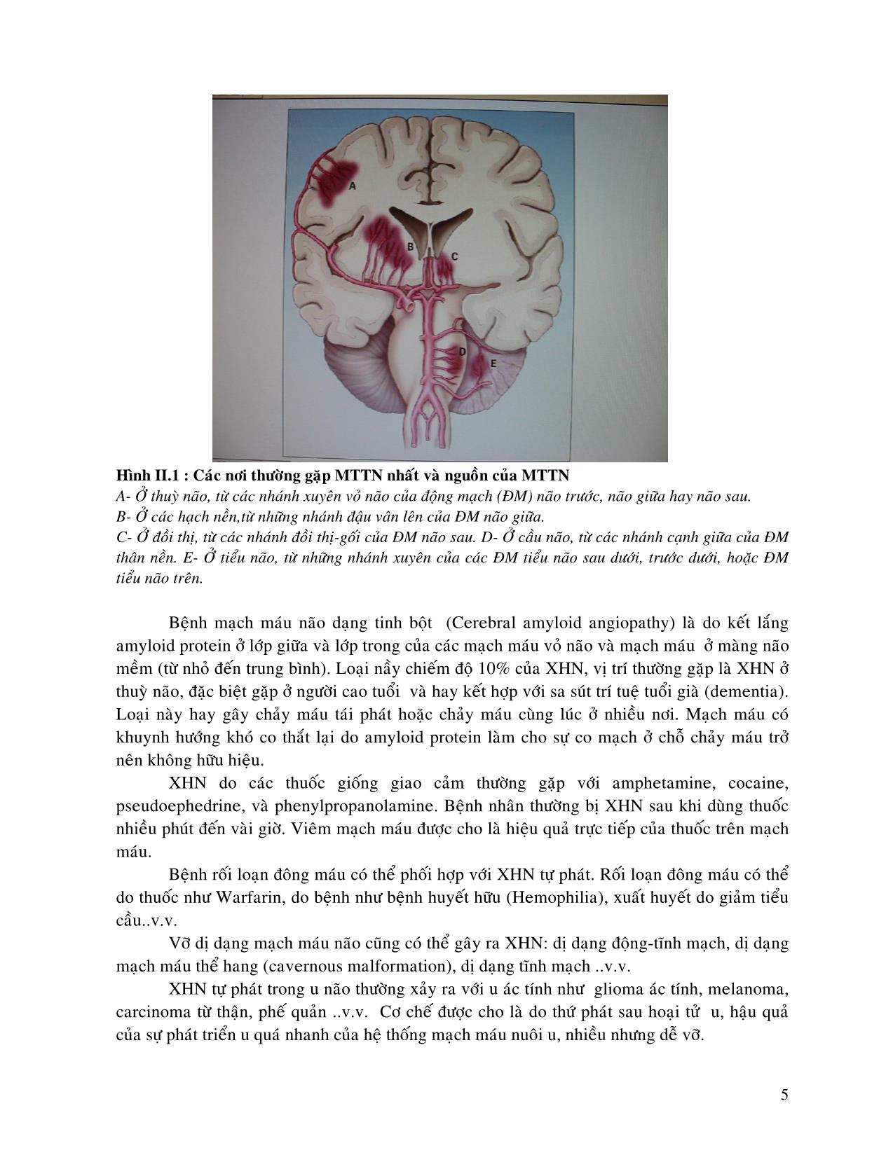 Vai trò của điều trị phẫu thuật trong tai biến mạch máu não trang 5