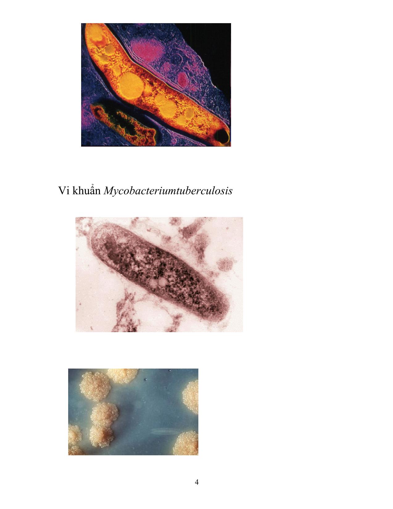 Đề tài Vắc xin phòng bệnh do vi khuẩn mycobacterum tuberculosis trang 4